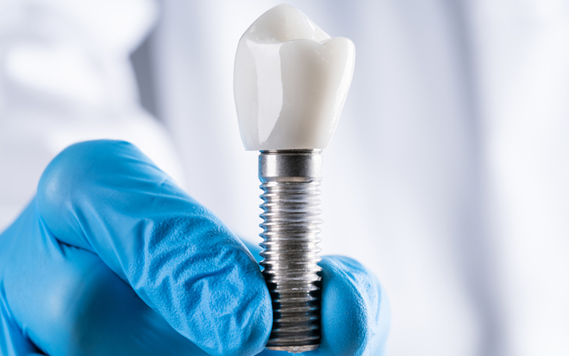 Implant specialist advanced technology at Greenwood Park Dentistry Kingston